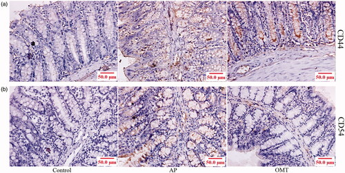 Figure 8. OMT inhibited Arg-induced CD44- and CD54-mediated inflammation in vivo. CD44 (a) and CD54 (b) expression in the intestine of control, AP and OMT groups using IHC assays (200×). Control: saline treatment group; AP: Arg treatment group; OMT: Arg combing with OMT treatment group.