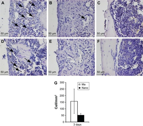 Figure 4 Immunohistochemical analysis of CD163-positive cells.Notes: The sections show the positively stained cells, monocytes and macrophages, at Ma (A–C) and Nano (D–F) implants. The analysis was performed at 3 days (A and D), 6 days (B and E), and 28 days (C and F). At 3 days, a higher amount of CD163-positive cells can be seen at the Ma implants compared to the Nano implants (denoted by arrows). After 6 days, a low number of stained cells can be seen on both surfaces, while at 28 days, monocytes/macrophages are not evident in the periimplant tissue. The column graph (G) shows the quantification of CD163-positively stained cells counted along the interface, extending 200 µm from the implant surface, and expressed as number of cells/mm2. The quantification was only performed on the 3-day sections (n=3), where well-preserved sections were used, showing an intact entire interface, at both sides of the implant.Abbreviations: Ma, machined; Nano, nanopatterned.