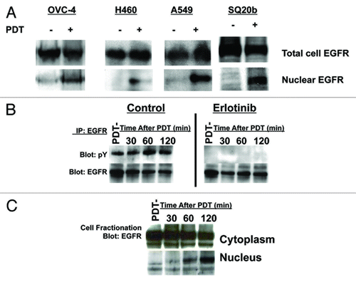 Figure 3. Response of OvCa, NSCLC and head and neck cancer (HNC) cell lines to BPD or porfimer sodium-mediated PDT. (A) OVCAR-4 (OvCa), H460 (NSCLC), A549 (NSCLC) or SQ20b (HNC) cells were treated with BPD-mediated PDT and total cell vs nuclear EGFR was analyzed as in Figure 2. (B) SKOV-3 (OvCa) cells were treated with porfimer-sodium PDT using 0.5 J/cm2 of 630 nm light and EGFR was immunoprecipitated as in Figure 1. The resultant immune complexes were analyzed by western blotting with anti-phosphotyrosine (pY) or EGFR antibodies. (C) SKOV-3 cells were treated as above and nucleocytoplasmic fraction and western blotting were performed as in Figure 2. All results in this figure are representative of experiments performed in triplicate.