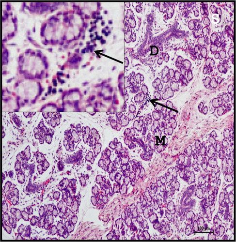 Figure 9. Photomicrograph of 28.3 cm CVRL (137th day) buffalo foetus showing the infiltration of lymphocytes (arrows) in the parenchyma of mandibular gland. (M-mucous acini; D-duct). Haematoxylin and Eosin method ×100.