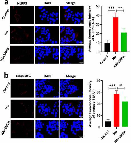 Figure 3. The results of immunofluorescence of β TC-6 cells treated with different conditions as described above for 24 h. (a) and (b) Immunofluorescence images showing expressions of NLRP3 and caspase-1 in β TC-6 cells under three different treatment conditions. * P < 0.05; ** P < 0.01; *** P < 0.001