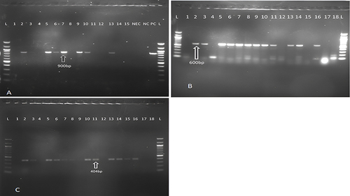 Figure 1 Gel electrophoresis picture showing the results for PCR amplification of blaSHV, blaTEM and blaCTX-M genes. Picture (A) Analysis for blaSHV (900bp); Lane L-100bp ladder; L2, L5, L6, L7, L9, L10 and L13 = samples positive for blaSHV; L1, L3, L4, L8, L11, L12, L14, L15 = samples negative for blaSHV. Picture (B) Analysis for blaCTX-M (600bp); Lane L-100bp ladder; L2, L3, L5, L6, L7, L8, L9, L10, L11, L13, L14 and L16 = samples positive for blaCTX-M; L1, L4, L12, L15, L17, L18 = samples negative for blaCTX-M. Picture (C) Analysis for blaTEM (404bp); Lane L-100bp ladder; L2, L3, L5, L6, L7, L8, L10, L11, L13, L14, L15, L16 = samples positive for blaTEM; L1, L4, L9, L12, L17, L18 = samples negative for blaTEM. NEC = negative extraction control; NC = negative control; PC = positive control.