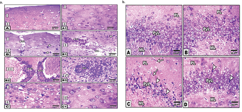 Figure 1. Histopathological changes of cerebral cortex and hippocampus of diabetic and peanut treated rats (a). Photomicrographs of sagittal histological section of cerebral cortex. A. Control. A1. Dietary peanut supplementation. B-B3. Diabetes showing blood vessel infiltration, glial cell condensation, angiogenesis of blood vessels, glial cell infiltration and gliosis. C-C1. Diabetes and Peanut supplementation. Note the improvement of the cerebral cortex. Abbreviations; BVI, blood vessel infiltration; Gl, gliosis. Star illustrated apoptotic neuronal cells. I. Molecular layer. II. External granular layer. III. Pyramidal layer. IV. Inner granular layer. (b) Photomicrographs of sagittal histological section of hippocampus of male rat. A. Control. B. Dietary peanut supplementation. C. Diabetes showing chromatolysis or grouping nuclear chromatin (apoptosis) of pyramidal cells. D. Diabetic and dietary supplemented Peanut showing an improvement.Abbreviations; ML, molecular layer, PL, polymorphic layer; PyL, pyramidal layer.
