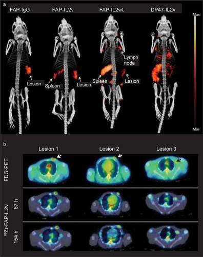 Figure 3. Biodistribution in animal models. (a) SPECT/CT imaging of 111In-labeled FAP-IgG, FAP-IL2v, FAP-IL2wt and DP47-IL2v in immunocompetent BALB/c mice (n = 3 per treatment) bearing renal carcinoma in the right kidney. Imaging was performed 3 days after IV injection of 0.3 μg 111In-labeled antibodies co-injected with 25 μg of corresponding unlabeled antibodies. (b) FDG-PET/CT axial view imaging of 89Zr-FAP-IL2v localization in lesions of a single rhesus monkey with breast carcinoma. The monkey was treated with 0.5 mg/kg of FAP-IL2v IV mixed with tracer amounts of 89Zr-labeled FAP-IL2v. PET scans were performed on the day of administration and 3 days (67 hours) and 6 days (154 hours) after IV injection. On-treatment biopsy was performed on Day 3 following the PET scan