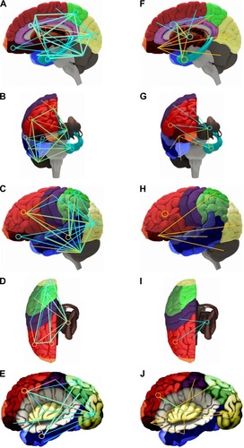 Figure 1 Functional connectivity (FC) for MDD patients compared with healthy controls for resting state (left) and task-related fMRI studies (right).Notes: A/F: sagittal, lateral view; b/g: sagittal, anterior view; C/H: lateral view of the surface; D/I: sagittal, dorsal view; E/J: lateral view, insula displayed by removing the opercular brain segments. The orange lines represent increased, the blue lines decreased FC. The circles indicate an altered self-referential connectivity (ie, within the region). Colors of the brain regions are coded according to Table 1.