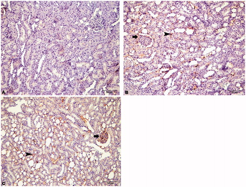 Figure 7. Immunohistochemical staining of Beclin-1 in rat kidney (200×). (A) HRs showed no immunopositivity, (B) DRs showed moderate immunopositivity in intertubular areas (arrowhead) and glomeruli (arrow), and (C) DRs + CN showed severe immunopositivity for Beclin-1 in intertubular areas (arrowhead) and glomeruli (arrow).