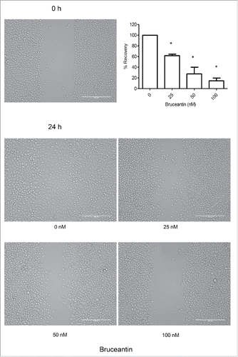 Figure 5. Effect of BCT on MM-CSCs migration. Confluent MM-CSCs were scratched using a 10 µL pipette tip, and photos of the scratch were taken immediately after the scratch. MM-CSCs were then treated with vehicle control or increasing concentrations of BCT for 24 h. Additional photos were taken at the exact same spot as before treatment in order to view differences in migration. Results are representative of 3 independent experiments (scale bar = 200 µm), and quantification of the migration effect was conducted as described in Materials and Methods. *Anti-migratory effect significantly different from vehicle control values as determined by a one-way ANOVA, followed by Bonferroni multiple comparison test (p < 0.05).