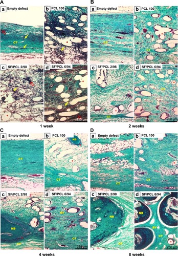 Figure 12 Masson’s trichrome-stained histological section after implantation.Notes: Representative histological sections show cross sections of the defect center after (A) 1 week, (B) 2 weeks, (C) 4 weeks, and (D) 8 weeks. Note the presence of blood clots (empty red arrows), inflammatory cells (thin yellow arrows), osteoblasts (arrowheads), and remaining scaffold (asterisks). Original magnification 100×.Abbreviations: PCL, poly(ε-caprolactone); SF, silk fibroin; NB, new bone; BV, blood vessel; CT, connective tissue.