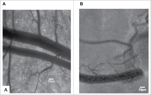 Figure 4. Intravital micrographs depicting functional capillary density (FCD) in NOD mice with low (A) and high (B) pancreatic inflammation. Fifteen minutes prior to IVM, NOD mice were administered bovine FITC-albumin via tail vein injection. It can be noted that animals with low degrees of inflammation possessed pancreatic microvasculature with very clearly defined and organized branching vessels (A); whereas, animals with high degrees of leukocyte activation had highly opaque pancreatic tissue, containing fewer perfused vessels and displayed irregular branching patterns in smaller vessels that branched from larger vessels (B).