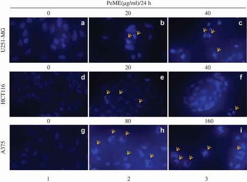 Figure 3. Apoptotic features in P. elegans methanolic extract (PeME) treated glioblastoma, colon, and melanoma cancer cells. (a–c) showed control, 20 and 40 µg/ml treated U251-MG and (d–f) showed control, 20 and 40 µg/ml treated HCT116 incubated for 24 h. Changes in the morphology of the cancer cells were observed under fluorescence microscope (200x magnification).