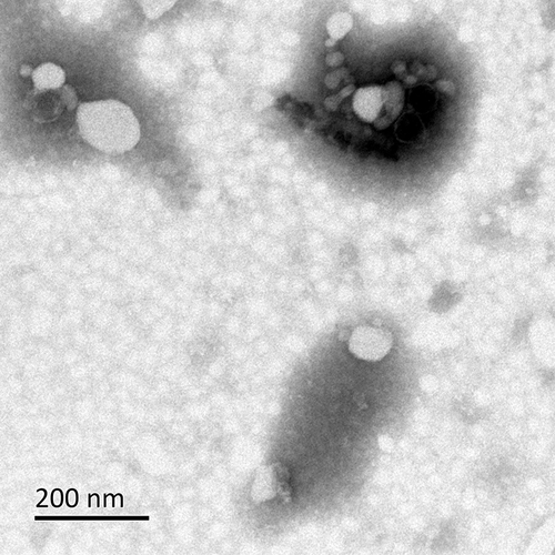 Figure 3 Observation of OMVs secreted by HVKP under the transmission electron microscope.