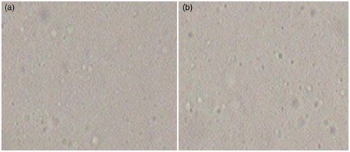 Figure 1. Leica optical microscopy of formulation (400×). (a) Blank elastic liposome and (b) optimized 5-FU loaded elastic liposome (without sonication).