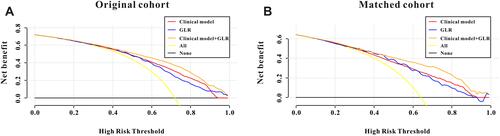 Figure 3 Decision curve analysis for preoperative GLR and clinical model to detect its clinical usefulness in the original cohort (A) and in the matched cohort (B).