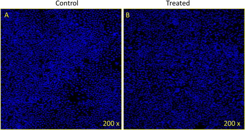 Figure 12. Cancer cell death due treatment of Sample 2: The treatment of Zinc phthalocyanine on colon cancer cells (HCT-116) has been analyzed with stained DAPI post-48-hour treatment. In the same regard, Figure A showcases the control cell and Figure B is treated with Zinc phthalocyanine along with observing no loss of any cell with the value of (30 µg/ml).