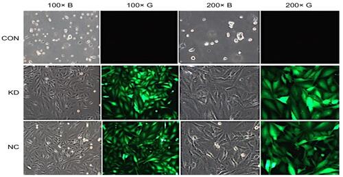 Figure 5 Cell pattern after puromycin screening.