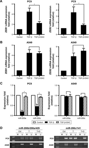 Figure 5 Epigenetic regulation of miR-200/ZEB axis is involved in TGF-β1-induced EMT.