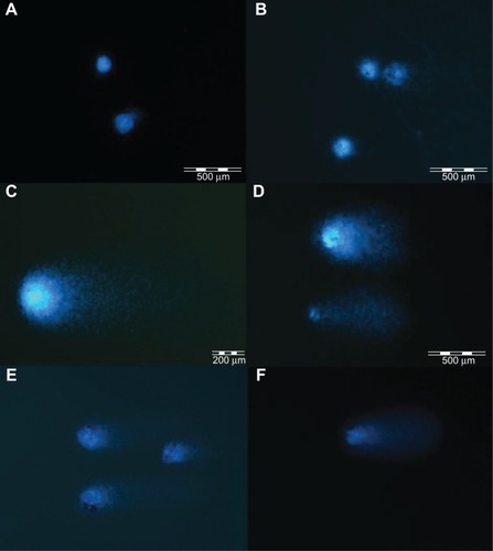 Figure 4 Images of comets from single-cell gel electrophoresis stained with DAPI (4′, 6-diamidino-2-phenylindole). Images show control cells (A) and cells incubated with graphene oxide (B), graphite (C), pristine graphene (D), graphite (E), and ultradispersed detonation diamond (F).