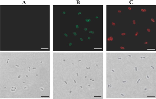 Figure 1. Analysis of bivalent BLPs vaccine binding IA-2ic and SCI-59 simultaneously (Bivalent vaccine-SA) by immunofluorescence microscopy. Immunofluorescence (top) and bright-field (bottom) microscopy images of BLPs alone (A) and bivalent BLPs vaccine (B and C). Two equal parts were taken from the obtained bivalent BLPs vaccine. One was revealed by incubation with an anti-IA-2 antibody followed by Alexa Fluor 488-labeled secondary antibody (green, B) and the other one was revealed by incubation with an anti-insulin antibody followed by Alexa Fluor 594-labeled secondary antibody (red, C). A similar analysis was performed for BLPs alone, and no fluorescence signal (green or red) was detected. Scale bar: 5 μm.