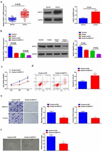 Figure 3. Elevated NAP1L1 is in LC; constrained NAP1L1 expedites Huaier’s therapy on LC. (a) RT-qPCR and Western blot detection of NAP1L1 in clinical samples; (b) RT-qPCR and Western blot verification of the successful transfection; (c) CCK-8 detection of cell proliferation; (d) Flow cytometry detection of cell apoptosis; (e) Transwell detection of cell migration and invasion; (f) Matrigel tube formation test of the angiogenesis ability (200 ×); C-F, after depressive NAP1L1. Expression of the values was as mean ± SD (N = 3). * vs. the Huaier + si-NC, P < 0.05.