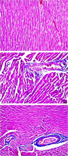 Figure 4. Degree of myocardial fibrosis in the three groups of rats Masson staining (×200) showing the degree of myocardial fibrosis in the three groups of rats, Erythrocytes, cardiac muscle fibers, and cytoplasm appear red, whereas myocardial interstitial collagen appears blue. (A) Masson staining mainly showing normal myocardial tissues in the normal control group. (B) Myocardial interstitial collagen fiber accumulation and obvious hyperplasia were observed in the myocardium of the DCM + control group. (C) Blue-stained collagen fibers were observed in the myocardium of the DCM + treatment group.