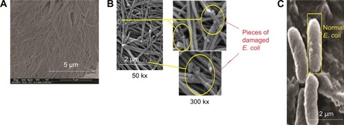 Figure 10 SEM images of membrane modified with carbon nanotube before (A) and after coming into contact with bacteria (B) and normal E. coli (C).Abbreviations: E. coli, Escherichia coli; SEM, scanning electron microscopy.