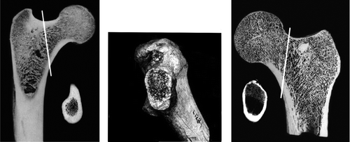 Figure 27. Bone distribution in the femoral neck. From left to right: Chimpanzee, Australopithecus afarensis (AL-128), H. sapiens (from Lovejoy Citation2005, and Ohman Citation1997, with permission).