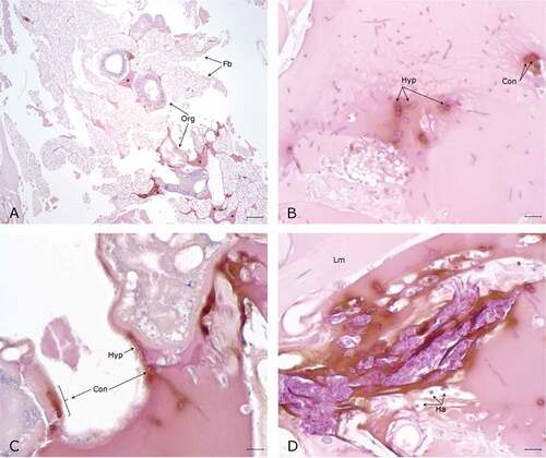 Figure 6. Histopathology of G. mellonella infected with P. destructans and kept at 5°C. A. Throughout the hemocoel there are numerous lakes of dense eosinophilic material with melanin deposition (*) around organelles (Org) and expanding in the fat body (Fb) (5x; scale 100 µm). B. Higher magnification of hemolymph lake with numerous PAS-positive hyphae (Hyp) and conidia (Con) with concomitant mild melanization. C. Hyphae and conidia on the surface of organelles eliciting moderate melanization. D. Densely packed PAS-positive hyphae and conidia expanding between longitudinal muscle fibers (Lm) eliciting marked melanization and the infiltration of hemocytes (Ha). (50x; scale 10 µm).