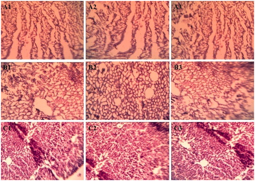 Figure 11. Representative histopathological sections of various organs showing effect of repeated topical application of amphotericin B in 28-d dermal toxicity study. (A) Heart, (B) kidney and (C) liver. (1) Untreated control, (2) treated NE-7.4 and (3) AMB-NE gel.