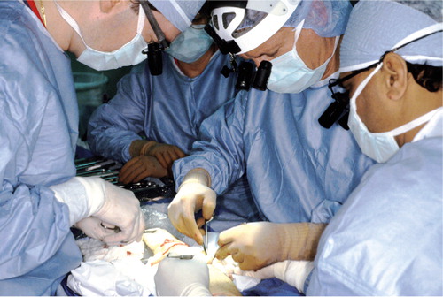 Figure 1. Doctors from Christine M. Kleinert Institute in Louisville, Kentucky, performing the first US hand transplantation in January 1999. The teams of surgeons were led by Dr. Warren C. Breidenbach III (second from the right).