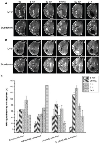 Figure 6 Representative in vivo MRI images of Sprague-Dawley rat liver injected with gadolinium-labeled reconstituted HDL. MRI images were obtained at different time points after injection of 10 μmol/kg (A) Gd-chol-HDL or (B) Gd-(chol)2-HDL. The five measured ROI used for the time courses in (A) and (B) are shown in the preinjection images. ROI1–3 and ROI4–5 were 6 mm and 2 mm in diameter, respectively. (C) Intensity enhancement of liver and the surrounding duodenum in vivo after injection of Gd-chol-HDL (n = 3) or Gd-(chol)2-HDL (n = 3).Note: Bars represent the mean ± standard deviation (n = 3).Abbreviations: Gd, gadolinium; chol, cholesterol; MRI, magnetic resonance imaging; HDL, high-density lipoprotein; ROI, region of interest.