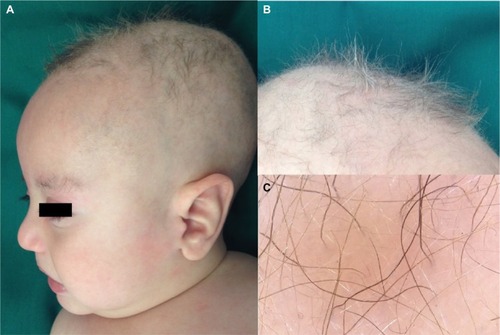 Figure 1 Clinical findings.