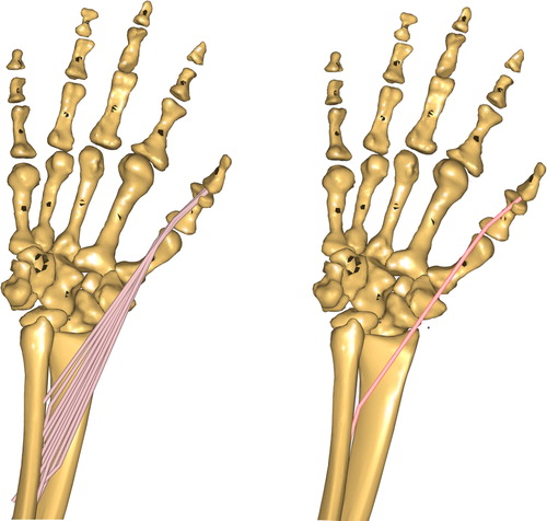 Figure 2. Detailed hand model with several representatives of one muscle (FPL) – left side. Hand model with only one representative for the same muscle – right side.
