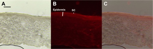 Figure 5 Microscopic images of minipig skin after NLC-MN application for 24 hours (A) under normal light, (B) under fluorescent light, and (C) a merged image of (A) and (B).Notes: The red color in (B) and (C) represents NR. The black scale bar represents 100 μm.Abbreviations: NLC-MN, nanostructured-lipid-carrier-loaded microneedle; NR, nile red; SC, stratum corneum.