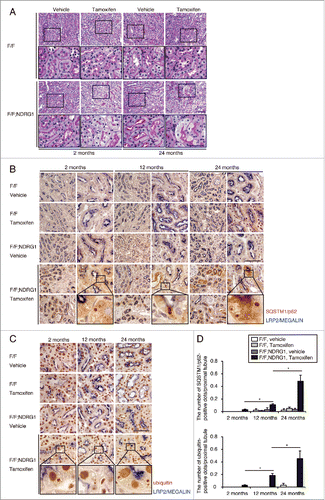 Figure 1. Aged kidney is more reliant on autophagy for the degradation of increasing substrates. (A) Representative images of PAS-stained kidney cortical regions of vehicle- or tamoxifen-treated 2- and 24-mo-old Atg5F/F and Atg5F/F-NDRG1 mice (n = 4 or 5 in each group). Bar: 50 μm. Magnified images are presented in the insets. (Band C) Immunostaining for SQSTM1 (B) and ubiquitin (C) in the kidneys of 2-, 12-, and 24-mo-old Atg5F/F and Atg5F/F-NDRG1 mice treated with vehicle or tamoxifen 2 wk before euthanasia. Bars: 50 μm. Images are representative of multiple experiments. Magnified images from tamoxifen-treated Atg5F/F-NDRG1 mice are presented in the insets. (D) The number of SQSTM1- or ubiquitin-positive dots was counted in at least 10 high-power fields (×400). Data are provided as mean ± SE. Statistically significant differences (*, P < 0.05) are indicated. F/F, Atg5F/F mice; F/F;NDRG1, Atg5F/F-NDRG1 mice.