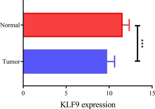Figure 1 Downregulated expression of KLF9 in breast cancer. ***P < 0.001.