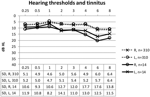 Figure 4. Hearing thresholds for children with normal middle-ear function. The dotted lines show the hearing thresholds for children without tinnitus, and the straight lines show the thresholds for children with tinnitus.