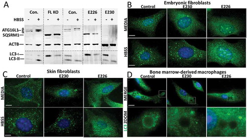 Figure 3. Role played by WD and linker domains of ATG16L1 during autophagy and LC3-associated phagocytosis. (A) MEFs from mice lacking ATG16L (FL KO), atg16l1E226 (E226) and atg16l1E230 (E230) and appropriate littermate controls were incubated in complete media or HBSS for 2 h to induce autophagy. Cell lysates were analyzed by western blot using antibodies specific for the indicated proteins. (B) MEFs or skin fibroblasts (C) from atg16l1E226 (E226) and atg16l1E230 (E230) mice and littermate controls were incubated in complete media or HBSS for 2 h to induce autophagy. Cells were immunostained for endogenous LC3. (D) BMDMs from atg16l1E226 (E226) and atg16l1E230 (E230) and appropriate littermate controls were incubated with Pam3CSK4-coupled polystyrene beads for 1.5 h in complete medium to induce LAP, and immunostained for endogenous LC3 (green). Boxed regions highlighting internalized beads are enlarged and shown in the lower panel. Magnification 63X, scale bars: 10 µm.