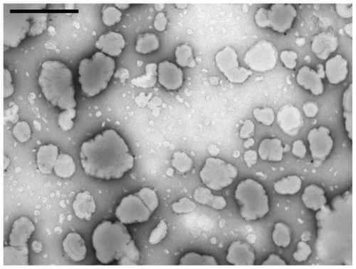 Figure 2 Electron micrograph of liposomes formed after the hydration of the dry phospholipids film containing OMC.Note: Scale bar = 500 nm.Abbreviation: OMC, octyl p-methoxycinnamate.
