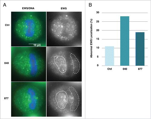 Figure 9. EWS spindle localization is disrupted in OGA knockdown cells. (A) (Right) EWS visualized with an anti-EWS antibody. Area with clustered EWS signal is shown with white line. Area with sparse EWS signal is shown with dashed while line. (Left) merged images of DNA stained with DAPI (blue) and EWS (green) visualized with an anti-EWS antibody. (B) The percentage of cells with aberrant localization of EWS (n=300 metaphase cells, per sample).