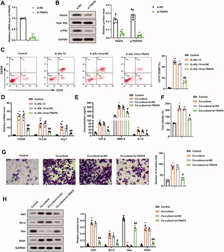 Figure 4. Regulation of TRAF6 on the growth and invasion of osteosarcoma cells induced by M2 phenotype macrophages. Si-TRAF6 or si-NC was transfected into THP-1 cells for 48 h. (A and B) The transfection efficiency of si-TRAF6 was confirmed using qRT-PCR and Western blot, and the protein quantification of TRAF6 and p-P65/P65 was presented. (C) The positive rate of M2 phenotype macrophages was determined by flow cytometry. (D) The mRNA levels of CD206, CCL24, and Arg-1 were assessed using qRT-PCR. (E) Comparison of TGF-β, MMP-9, and IL-10 contents by ELISA. (F) M2 phenotype macrophages transfected with si-TRAF6 were co-cultured with osteosarcoma cells. The viability of U2OS cells was measured using a CCK-8 assay. (G) Analysis of the U2OS cell invasion by Transwell and the quantitative results of cell invasion. (H) Detection of the Ki-67, Bcl-2, Bax, and VEGF protein levels using Western blot. **p < 0.01 vs. si-NC. *p < 0.05, **p < 0.01 vs. control. #p < 0.05, ##p < 0.01 vs. co-culture + si-NC. Each assay was conducted in triplicate. NC, negative control.