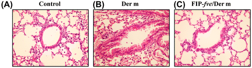 Fig. 3. Effect of FIP-fve treatment on airway responsiveness in Der m-challenged mice.