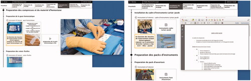 Figure 4. Surgical declarative knowledge assigned to phases and steps of PSTC with multimedia documents opened (video and pdf) in French version.