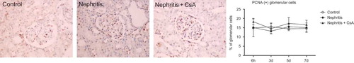 Figure 6.  PCNA expression in glomeruli of rat kidneys during the experimental period and histological appearances of kidneys in control (at sixth hour), nephritis (at sixth hour), and nephritis + CsA (at sixth hour) groups. Values are expressed as mean ± SEM. n = 6 at each time point for each group. Note: CsA, cyclosporine A.