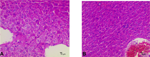 Figure 7 The pathological changes of the liver tissue of MRSA-infected mice. (A): control group, (B): model group.