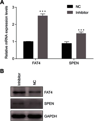 Figure 6 Confirmation of mRNA sequencing results by qRT-PCR. (A) Two genes were selected for the qRT-PCR analysis, including FAT4 and SPEN The GAPDH was chosen as the internal control. All data are shown as the average value of 3 independent experiments. Error bars indicate ± SEM. (B) Endogenous FAT4 and SPEN was immunoprecipitated with anti- FAT4 and anti-SPEN antibody after treating the cells with tsRNA-26576 inhibitor.Abbreviation: NC, normal control.