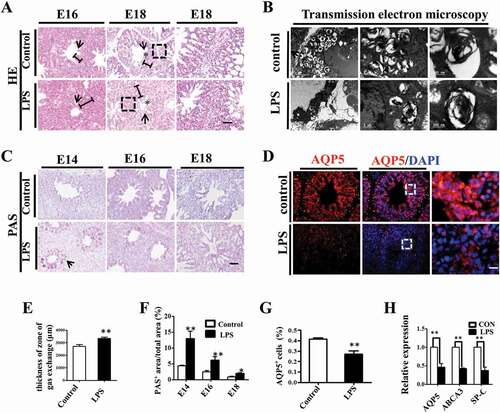 Figure 2. LPS induced microscopic alteration in chick embryonic lungs. (A, E): H&E staining was performed on transverse sections of chick lungs. The alveolar wall and gas exchange zone are indicated with arrows and line segments, respectively. LPS increased gas exchange zone thickness, and control lungs display a more mature spongy phenotype at E18. (B): The representative TEM images of E18 chick lungs shows lamellar bodies at multiple spherical particles, ranging from 500nm to 5 μm. LPS significantly reduced LB count. (C, F): PAS staining was performed on transverse sections of embryonic chick lungs. LPS induced more PAS+ areas relative to total areas in embryonic chick lungs. (D, G): In immunofluorescent staining of E18 chick lungs, red color shows AQP5 and blue color shows DAPI staining, respectively. The far right panel indicates the dotted squares with higher magnification. LPS significantly reduced AQP5+ cells in E18 chick lungs. (H): qPCR data show LPS significantly induced down-regulation of AQP5, ABCA3 and SP-C expression at mRNA level in E18 lungs. *P < 0.05. **P < 0.01 .Scale bars = 50μm.