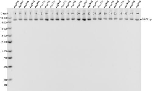 Figure 3 Representative result of ethidium bromide-stained agarose gel electrophoresis showed no abnormal mtDNA sequence deletion in mtDNA4977 deletion detection of leukocytes from T2DM patients. Genotypes of the TP53 Pro72Arg polymorphism and patient IDs are shown, respectively.