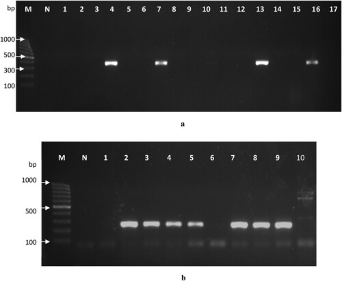 Figure 3. (a) A representative gel electrophoresis of PCR amplification using primer target on cpsIII gene for serotype III (389 bp). PCR amplicons of cpsIII were shown in lanes 4, 7, 13 and 16. Lanes with no band indicate that the cpsIII gene was not detected. Lane M: 100 bp DNA ladder, lane N: no template control, lanes 1–17: representative GBS isolates. (b) A representative gel electrophoresis of PCR amplification to target virulence gene of scpB (255 bp). PCR amplicons of scpB were shown in lanes 3–6 and 8–10. Lanes with no band indicate that the gene was not detected. Lane M: 100 bp DNA ladder, lane N: no template control, lanes 1–10: representative GBS isolates.