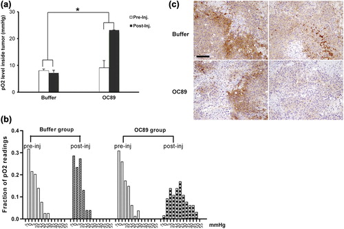 Figure 2. Attenuation of hypoxia by OC89 in tumor tissues. The rats were divided into two groups, being given either Ringer's buffer or oxygen carrier via tail vein injection. pO2 readings were measured both before and 1 h after interference. (a) Improved oxygenation by OC89. The data were shown as mean ± SD. * p < 0.05. (b) Shift of pO2 fraction from low (0–10 mmHg) to high readings (15–25 mmHg) after OC89 delivery. (c) Expression of hypoxia marker pimonidazole after interference. Immunostaining showed less binding to pimonidazole (lower panel) in tumor tissue after delivery of OC89 (Bar = 100 um).