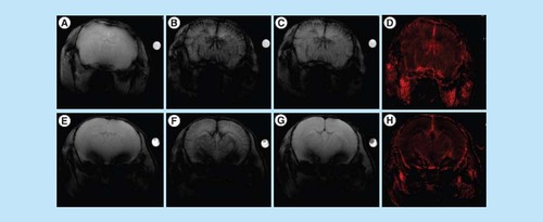 Figure 5.  In vivo perfusion MRI.T2*-weighted images for a mouse brain vasculature before (A, E), 5 min (B, F) and 2 h (C, G) after injection of Endorem® (upper panel) and bioferrofluids (lower panel). rCBV maps for Endorem and bioferrofluids are shown in (D) and (H), respectively.rCBV: Regional cerebral blood volume